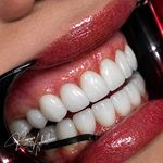 دکتر پریا اقاخانی،وام‌۱۵۰میلیونی دننالیت