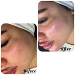 خدمات تخصصی فیشال سارا اسکین بار