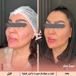 مرکز پزشکی و زیبایی میروژ سنتر