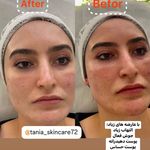 خدمات فیشیال و پاکسازی پوست