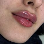 کلینیک زیبایی و جوانسازی پوست و مو الین