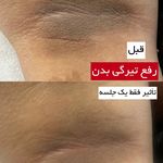 مرکز لیزر وکلینیک زیبایی پایون(بانوان)