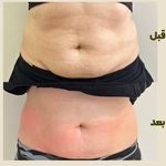 مرکز تخصصی زیبایی، تغذیه و لاغری پگاه
