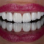 کلینیک تخصصی دندانپزشکی آلفا(بیمه داریم)