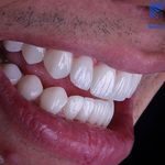 دندانپزشکی پرتو صادقیه از دم قسط با بیمه