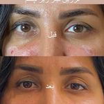 کلینیک پوست و مو و لیزر نیلوفر آبی