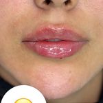 کلینیک زیبایی و لیزر لوتوس