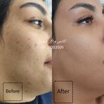 آموزشگاه فیشال و هد اسپا مژگان تیموری