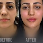 کلینیک ژل بوتاکس لیزر فیل بیوتی