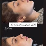 مرکز لیزر ،پوست و زیبایی کندی بیوتی