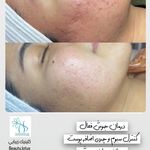 کلینیک پوست و مو و لیزر نیلوفر آبی