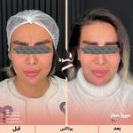 مرکز پزشکی و زیبایی میروژ سنتر