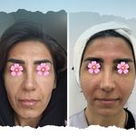 کلینیک زیبایی هانا