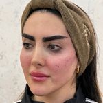 کلینیک زیبایی و پوست سلین