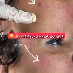 مرکز لیزر و کلینیک زیبایی پریفا