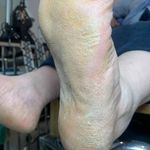 خدمات تخصصی پدیکور ملینا فرخ پور