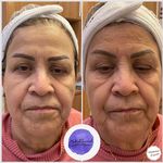 آموزش پاکسازی پوست،مدرس فنی حرفه ای
