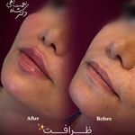 مرکز تخصصی پوست، مو،لیزر باران