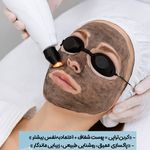 مرکز تخصصی لیزر موهای زائد فلای بیوتی