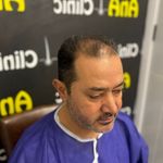 کاشت مو در جهرم
