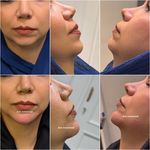 مرکز لیزر و زیبایی آرورا