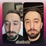 مطب پوست ،مو و لیزر یسنا طب