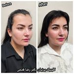 کلینیک تخصصی کاشت موی پرنیان