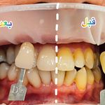 مطب دندانپزشکی دکتر فاطمه محمودی افصح