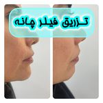 کلینیک پوست،مو و لیزر هانا