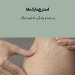 کلینیک زیبایی و لاغری بلو بیوتی|پاسداران
