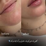 مرکز لیزر و کلینیک زیبایی پریفا