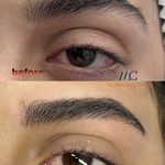 مرکز میکروبلیدینگ فیبروز ابرو