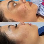 مرکز تخصصی پاکسازی پوست سیما عالینژاد