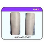 مرکز اپیلاسیون آراد (مریم تقیزاده)