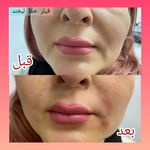 کلینیک پوست،مو،زیبایی و لیزر دالیا