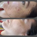 کلینیک زیبایی، لیزر، لاغری دُریتا