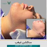 کلینیک پوست ، مو و لیزر نارینا