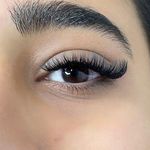 کاشت مژه مونلَش (Moonlash)