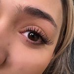 کاشت مژه مونلَش (Moonlash)