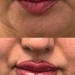 مطب  دکتر ملینا پورکاظمی