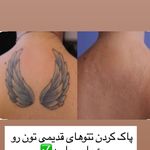 کلینیک زیبایی و لیزر لوتوس