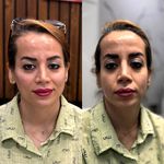 کلینیک تخصصی لیزر موهای زائد پریناز شرق