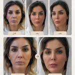 کلینیک زیبایی پوست و لیزر آلن