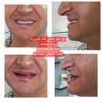 دندان سازی محلاتی