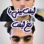 کلینیک پوست مو و زیبایی دکتر زلفی