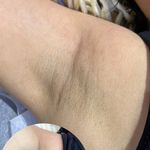 خدمات تخصصي پوست و تيرگي هاي بدن محبوبه