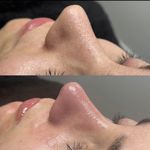 خدمات پاکسازی پوست و اسکالپ سر نازنین