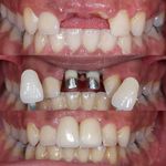 دنداپزشکی دکتر یاشار معزز