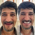 دندانسازی محلات (فتح المبین )