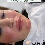 کلینیک زیبایی کاترین